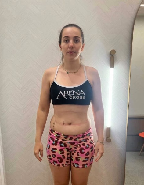 Thaís Ferrarez - Antes
